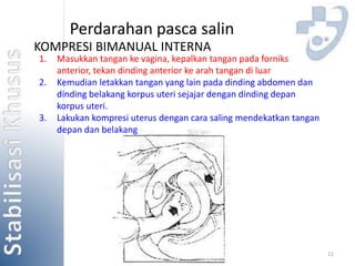 11 
Perdarahan pasca salin 
KOMPRESI BIMANUAL INTERNA 
1. Masukkan tangan ke vagina, kepalkan tangan pada forniks 
anterior, tekan dinding anterior ke arah tangan di luar 
2. Kemudian letakkan tangan yang lain pada dinding abdomen dan 
dinding belakang korpus uteri sejajar dengan dinding depan 
korpus uteri. 
3. Lakukan kompresi uterus dengan cara saling mendekatkan tangan 
depan dan belakang 
 
