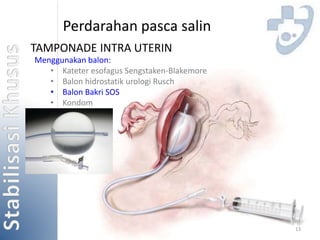 13 
Perdarahan pasca salin 
TAMPONADE INTRA UTERIN 
Menggunakan balon: 
• Kateter esofagus Sengstaken-Blakemore 
• Balon hidrostatik urologi Rusch 
• Balon Bakri SOS 
• Kondom 
 