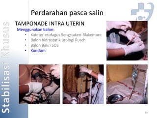 14 
Perdarahan pasca salin 
TAMPONADE INTRA UTERIN 
Menggunakan balon: 
• Kateter esofagus Sengstaken-Blakemore 
• Balon hidrostatik urologi Rusch 
• Balon Bakri SOS 
• Kondom 
 
