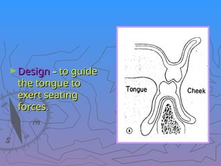 ►Design
Design –
– to guide
to guide
the tongue to
the tongue to
exert seating
exert seating
forces
forces.
.
 