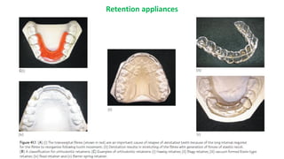 Stability and retention.pdf