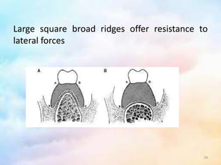 Sufficient Ridges Stability and support in complete denture | PPTX
