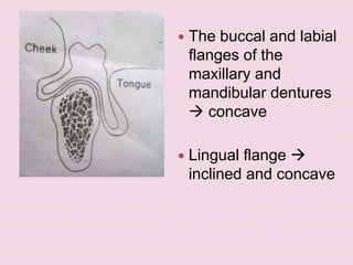  The buccal and labial
flanges of the
maxillary and
mandibular dentures
 concave
 Lingual flange 
inclined and concave
 