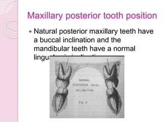 Maxillary posterior tooth position
 Natural posterior maxillary teeth have
a buccal inclination and the
mandibular teeth have a normal
lingual axis inclination
 