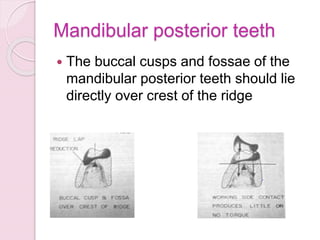 Mandibular posterior teeth
 The buccal cusps and fossae of the
mandibular posterior teeth should lie
directly over crest of the ridge
 