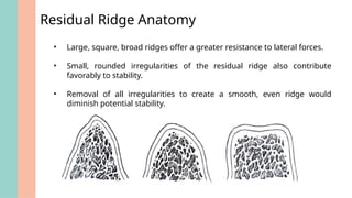 Comprehensive Analysis of Complete Denture Stability and Contributing ...