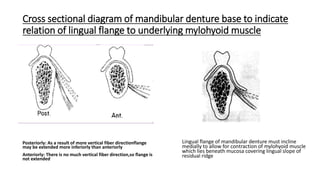 Cross sectional diagram of mandibular denture base to indicate
relation of lingual flange to underlying mylohyoid muscle
Posteriorly: As a result of more vertical fiber directionflange
may be extended more inferiorly than anteriorly
Anteriorly: There is no much vertical fiber direction,so flange is
not extended
Lingual flange of mandibular denture must incline
medially to allow for contraction of mylohyoid muscle
which lies beneath mucosa covering lingual slope of
residual ridge
 