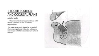 II TOOTH POSITION
AND OCCLUSAL PLANE
Anterior teeth:
The anterior teeth arrangement must fulfil
certain functional as well as esthetic
requirements.
The lower anteriors if placed far forward of
the remaining alveolar ridge, the orbicularis
oris muscle will lift the lower denture when it
contacts
 