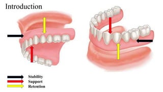 Stability Support Rect Stability in complete denture | PPTX