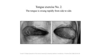 Tongue exercise No. 2.
The tongue is swung rapidly from side to side.
Corwin R. Wright,Evaluation of the factors necessary...