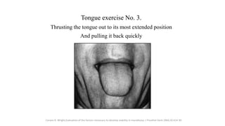 Tongue exercise No. 3.
Thrusting the tongue out to its most extended position
And pulling it back quickly
Corwin R. Wright...