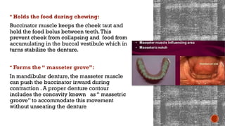Stability in Complete Denture [Autosaved].pptx