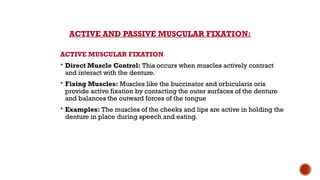 Stability in Complete Denture [Autosaved].pptx