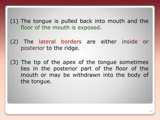 (1) The tongue is pulled back into mouth and the
floor of the mouth is exposed.
(2) The lateral borders are either inside or
posterior to the ridge.
(3) The tip of the apex of the tongue sometimes
lies in the posterior part of the floor of the
mouth or may be withdrawn into the body of
the tongue.
59
 