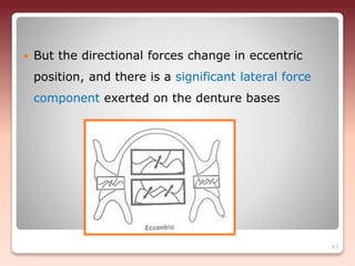  But the directional forces change in eccentric
position, and there is a significant lateral force
component exerted on the denture bases
67
 