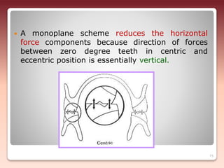  A monoplane scheme reduces the horizontal
force components because direction of forces
between zero degree teeth in centric and
eccentric position is essentially vertical.
75
 