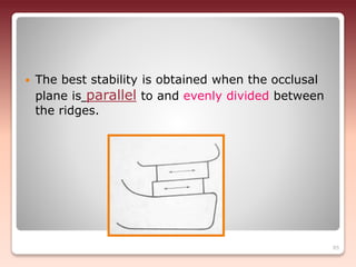  The best stability is obtained when the occlusal
plane is parallel to and evenly divided between
the ridges.
85
 