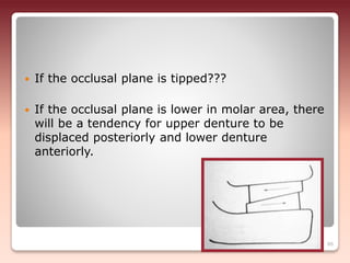  If the occlusal plane is tipped???
 If the occlusal plane is lower in molar area, there
will be a tendency for upper denture to be
displaced posteriorly and lower denture
anteriorly.
86
 