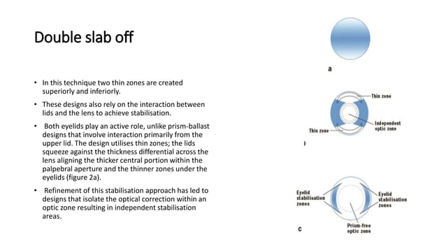 Contact Lens Rotation STABILIZATION PROCEDURE FOR REDUCE THE ROTATION OF CONTACT LENCE.pptx ...