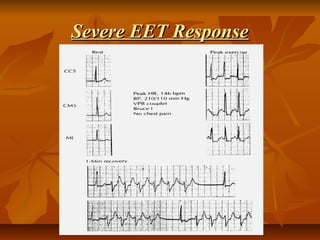 Severe EET ResponseSevere EET Response
 