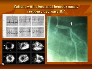 Patient with abnormal hemodynamicPatient with abnormal hemodynamic
response decrease BPresponse decrease BP
 