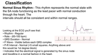 Sa Node Normal Rhythm Stable & Unstabe Tachycardia.pptx