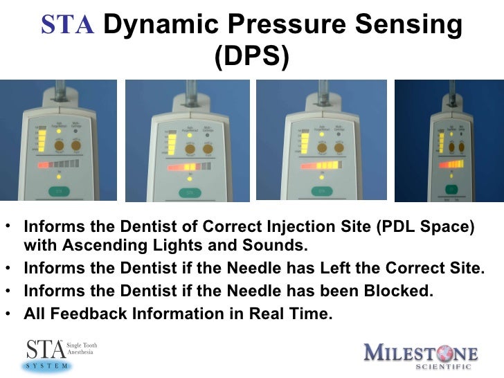 Sta Features Training Intralig.Inject. Erc