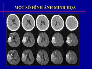MỘT SỐ HÌNH ẢNH MINH HỌA
 