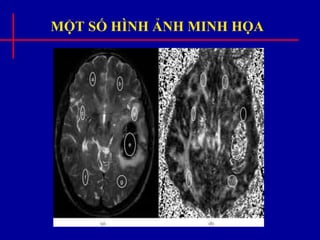MỘT SỐ HÌNH ẢNH MINH HỌA
 