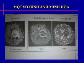 MỘT SỐ HÌNH ẢNH MINH HỌA
 