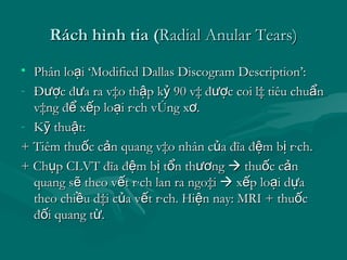 Hình ảnh học Thoát vị đĩa đệm | PDF