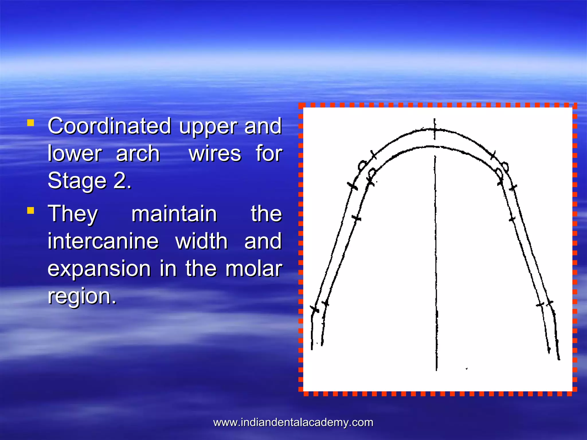 www.indiandentalacademy.comwww.indiandentalacademy.com
 Coordinated upper andCoordinated upper and
lower arch wires forlower arch wires for
Stage 2.Stage 2.
 They maintain theThey maintain the
intercanine width andintercanine width and
expansion in the molarexpansion in the molar
region.region.
 
