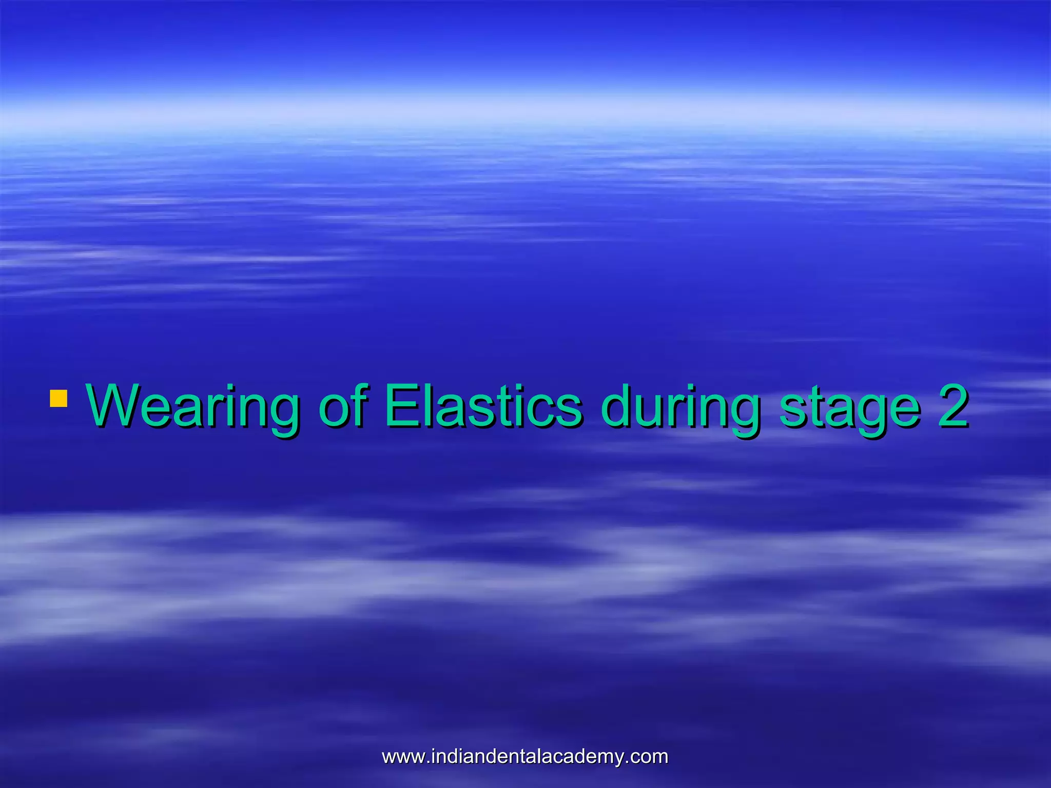 www.indiandentalacademy.comwww.indiandentalacademy.com
 Wearing of Elastics during stage 2Wearing of Elastics during stage 2
 