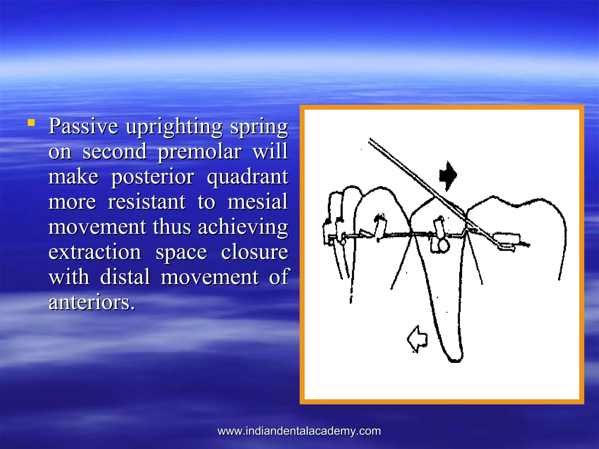 www.indiandentalacademy.comwww.indiandentalacademy.com
 Passive uprighting springPassive uprighting spring
on second premolar willon second premolar will
make posterior quadrantmake posterior quadrant
more resistant to mesialmore resistant to mesial
movement thus achievingmovement thus achieving
extraction space closureextraction space closure
with distal movement ofwith distal movement of
anteriors.anteriors.
 