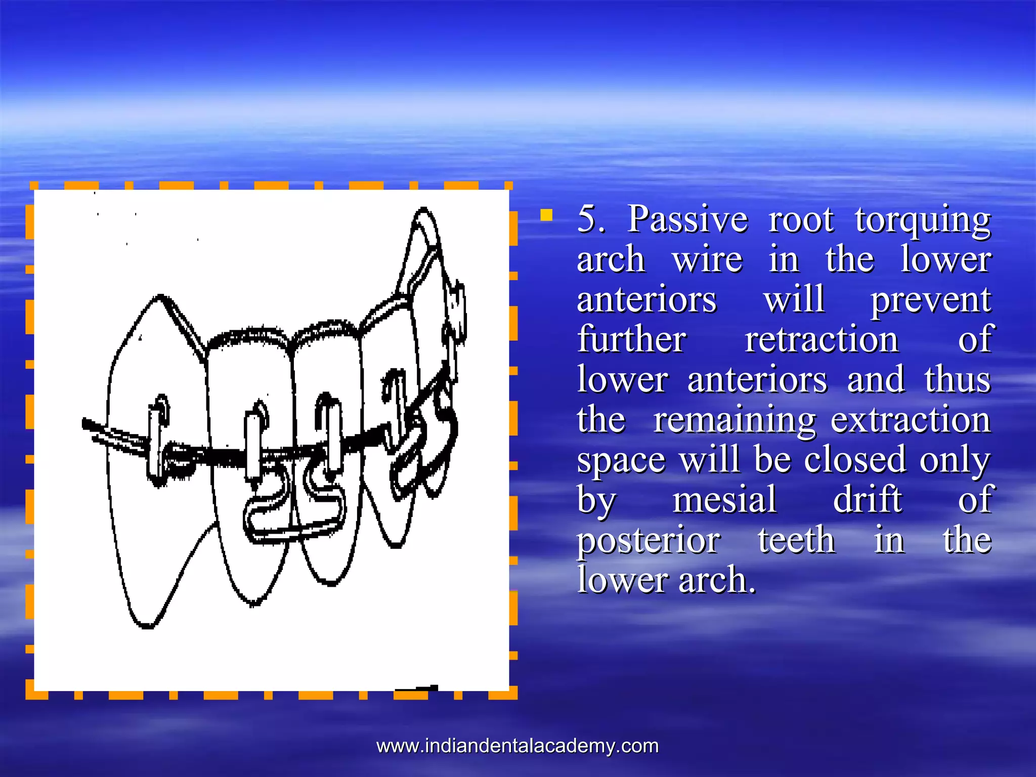 www.indiandentalacademy.comwww.indiandentalacademy.com
 5. Passive root torquing5. Passive root torquing
arch wire in the lowerarch wire in the lower
anteriors will preventanteriors will prevent
further retraction offurther retraction of
lower anteriors and thuslower anteriors and thus
the remaining extractionthe remaining extraction
space will be closed onlyspace will be closed only
by mesial drift ofby mesial drift of
posterior teeth in theposterior teeth in the
lower arch.lower arch.
 