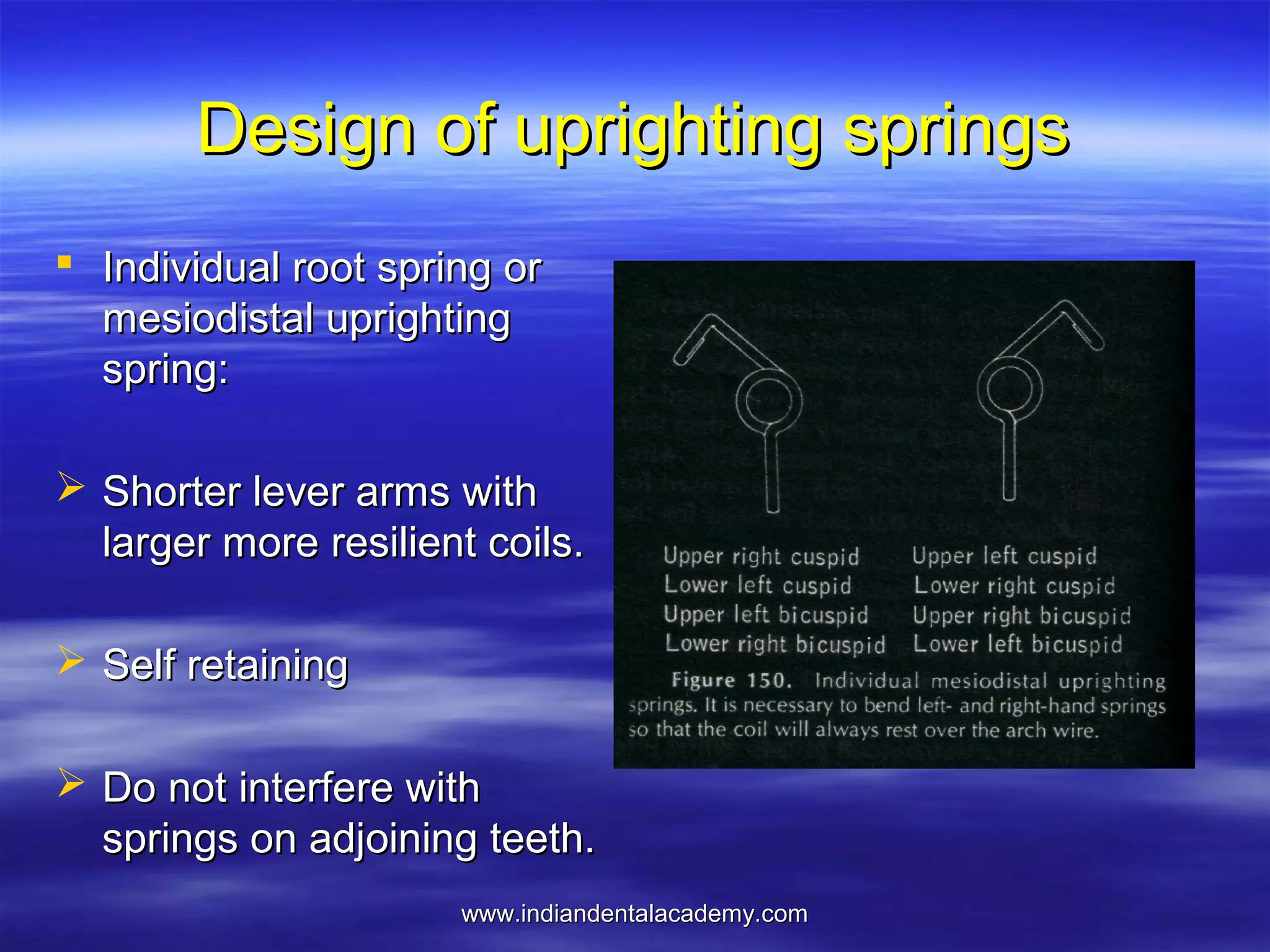 www.indiandentalacademy.comwww.indiandentalacademy.com
Design of uprighting springsDesign of uprighting springs
 Individual root spring orIndividual root spring or
mesiodistal uprightingmesiodistal uprighting
spring:spring:
 Shorter lever arms withShorter lever arms with
larger more resilient coils.larger more resilient coils.
 Self retainingSelf retaining
 Do not interfere withDo not interfere with
springs on adjoining teeth.springs on adjoining teeth.
 