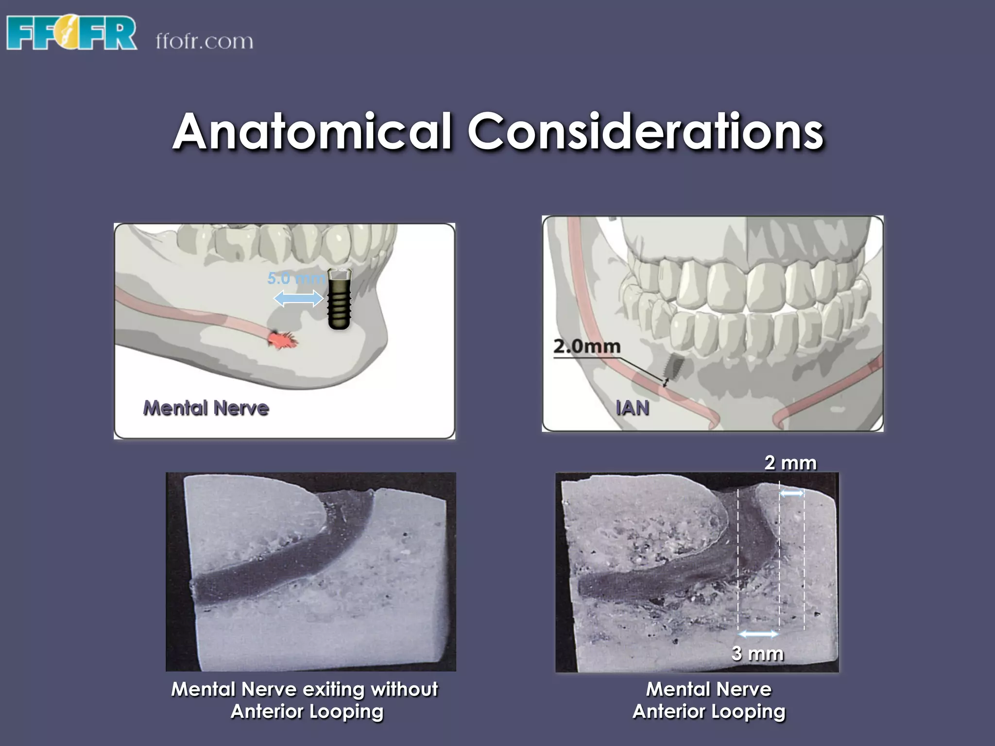 Stage i & ii surgery | PDF