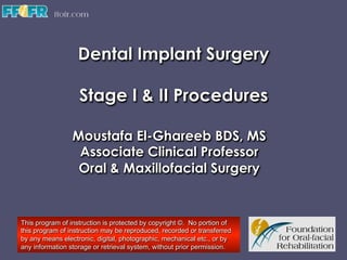 Dental Implant Surgery
Stage I & II Procedures
Moustafa El-Ghareeb BDS, MS
Associate Clinical Professor
Oral & Maxillofacial Surgery

This program of instruction is protected by copyright ©. No portion of
this program of instruction may be reproduced, recorded or transferred
by any means electronic, digital, photographic, mechanical etc., or by
any information storage or retrieval system, without prior permission.

 