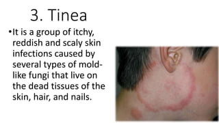 Reddish Infection STAGES INFECTION.pptx