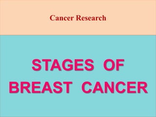 Cancer Research
STAGES OF
BREAST CANCER
 