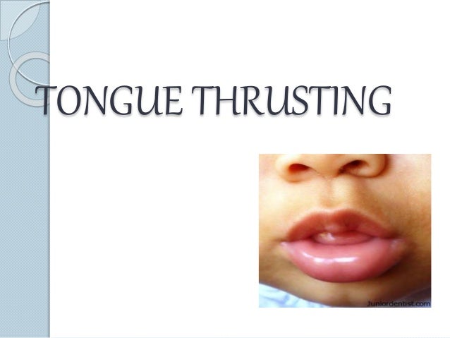 Stages of deglutition and tongue thrusting