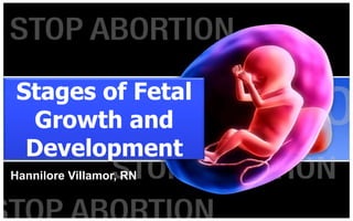 Stages of Fetal
   Growth and
  Development
Hannilore Villamor, RN
 