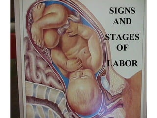 SIGNS AND STAGES OF LABOR 