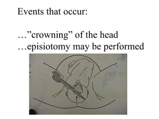 Events that occur: …” crowning” of the head … episiotomy may be performed 