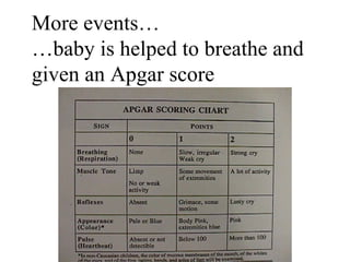 More events… … baby is helped to breathe and given an Apgar score 