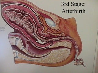 3rd Stage: Afterbirth 