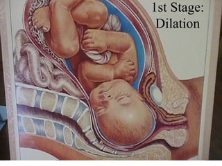1st Stage: Dilation 