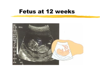 Fetus at 12 weeks

 