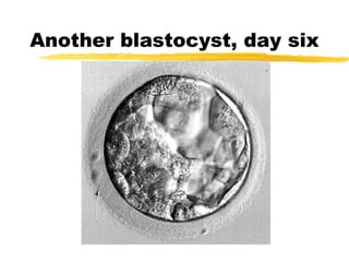 Another blastocyst, day six

 