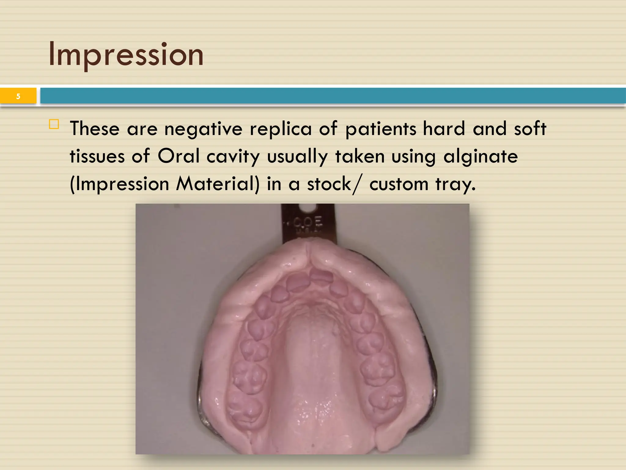 Impression
 These are negative replica of patients hard and soft
tissues of Oral cavity usually taken using alginate
(Impression Material) in a stock/ custom tray.
5
 